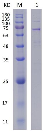 12% SDS-PAGE analysis profiles of purified RL2_PA2688-341-746_PA2688-26-256 (CBB stained).